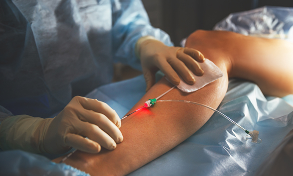 3 https://www.varicesyulceras.com/wp-content/uploads/2024/07/3.jpg