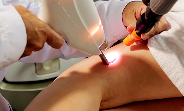 laser-transdermico https://www.varicesyulceras.com/wp-content/uploads/2024/07/laser-transdermico.jpg